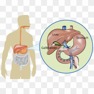 Pancreas - Sick Pancreas Clipart, HD Png Download - 1024x538 (#6134587 ...