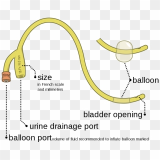 Foley Catheter Inflated And Deflated En - Parts Of Urinary Catheter, HD ...