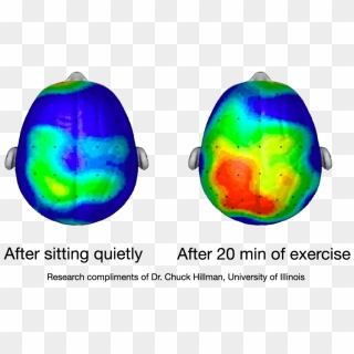 Brain Activity Exercise - Brain Scan After 20 Minute Walk, HD Png ...