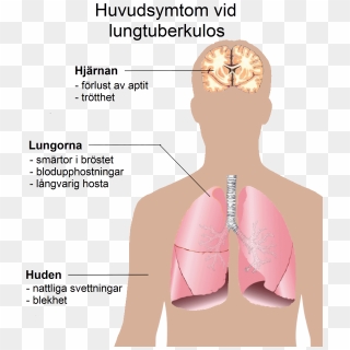 Pulmonary Tuberculosis Symptoms - Symptoms Of Aids, HD Png Download ...