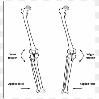 Direction Of Force Application And The Resulting Motion - Valgus Vs ...